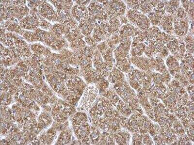 Immunohistochemistry-Paraffin: ETFA Antibody [NBP2-16383]