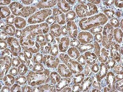 Immunohistochemistry-Paraffin: ETFA Antibody [NBP2-16383]
