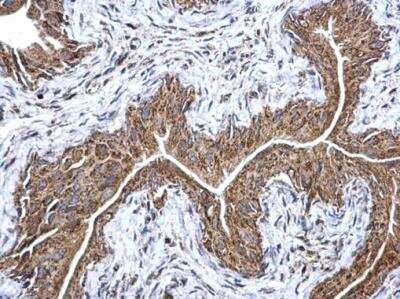 Immunohistochemistry-Paraffin: ETFA Antibody [NBP2-16383]