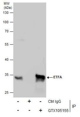 Immunoprecipitation: ETFA Antibody [NBP2-16382]