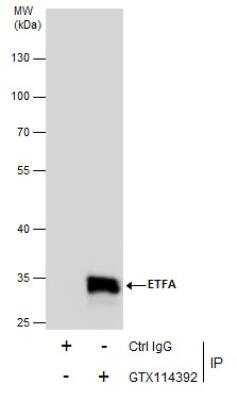 Immunoprecipitation: ETFA Antibody [NBP2-16383]