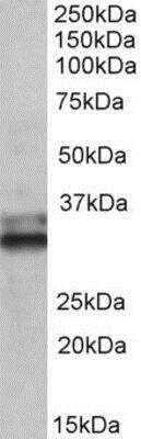 Western Blot: ETFA Antibody [NBP1-52058]