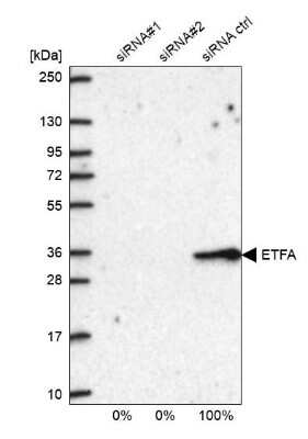 Western Blot: ETFA Antibody [NBP1-84854]