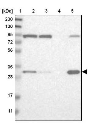 Western Blot: ETFA Antibody [NBP1-84855]