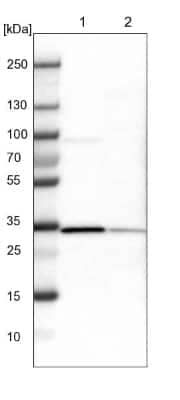 Western Blot: ETFA Antibody [NBP1-84856]