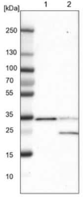 Western Blot: ETFA Antibody [NBP1-84857]