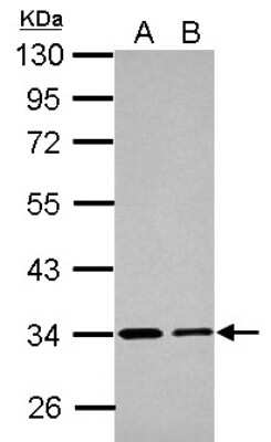 Western Blot: ETFA Antibody [NBP2-16382]