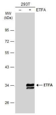 Western Blot: ETFA Antibody [NBP2-16382]