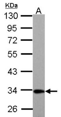 Western Blot: ETFA Antibody [NBP2-16383]