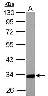 Western Blot: ETFA Antibody [NBP2-16383]