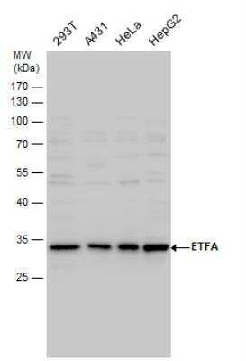Western Blot: ETFA Antibody [NBP2-16383]