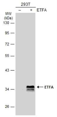 Western Blot: ETFA Antibody [NBP2-16383]