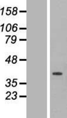 Western Blot: ETFA Overexpression Lysate [NBL1-10349]