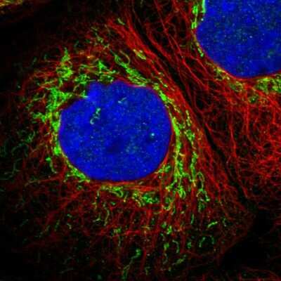 Immunocytochemistry/ Immunofluorescence: ETFB Antibody [NBP1-89455]