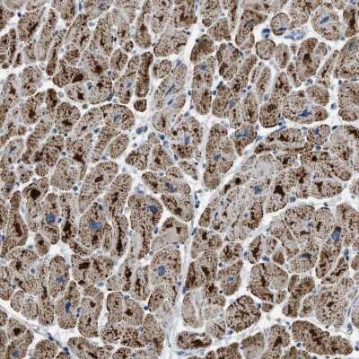 Immunohistochemistry-Paraffin: ETFB Antibody [NBP1-89455]