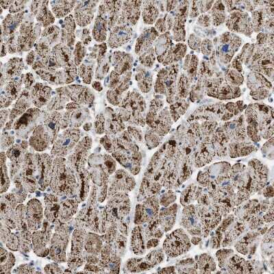 Immunohistochemistry-Paraffin: ETFB Antibody [NBP1-89545]