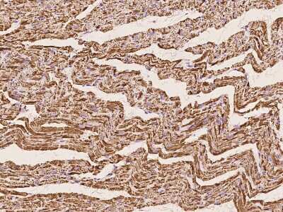 Immunohistochemistry-Paraffin: ETFB Antibody [NBP2-97524]