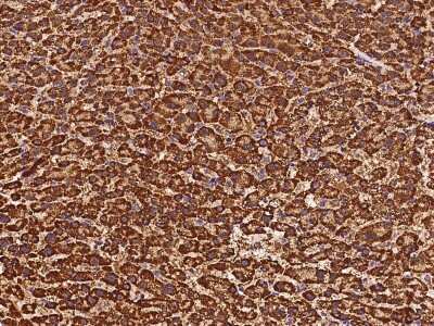 Immunohistochemistry-Paraffin: ETFB Antibody [NBP2-97524]