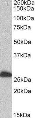 Western Blot: ETFB Antibody [NBP1-49843]