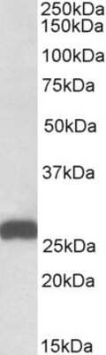 Western Blot: ETFB Antibody [NBP1-49844]