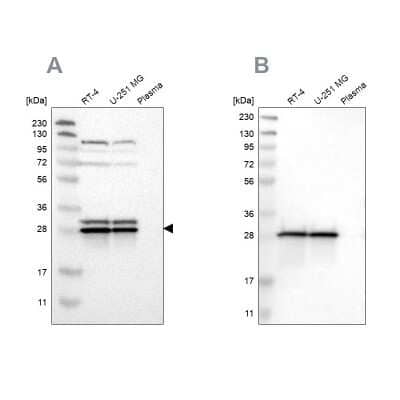 Western Blot: ETFB Antibody [NBP1-86040]