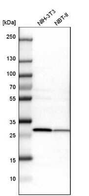 Western Blot: ETFB Antibody [NBP1-89545]