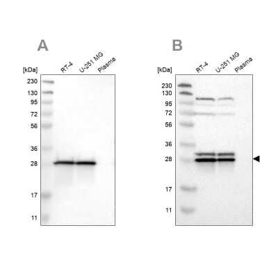 Western Blot: ETFB Antibody [NBP1-89545]
