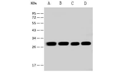 Western Blot: ETFB Antibody [NBP2-97524]