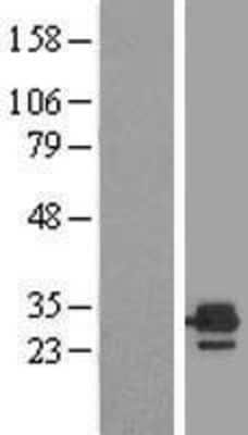 Western Blot: ETFB Overexpression Lysate [NBL1-10350]