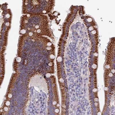 Immunohistochemistry-Paraffin: ETFDH Antibody [NBP1-83950]