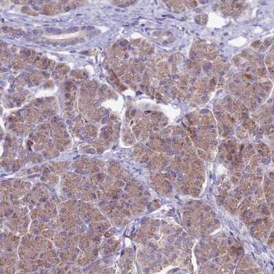 Immunohistochemistry-Paraffin: ETFDH Antibody [NBP1-83950]