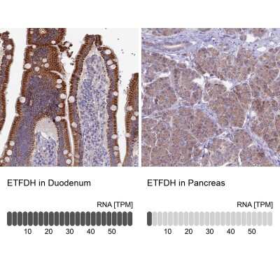 Immunohistochemistry-Paraffin: ETFDH Antibody [NBP1-83950]