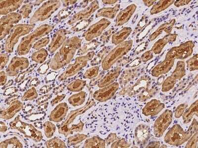 Immunohistochemistry-Paraffin: ETFDH Antibody [NBP2-97166]