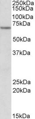 Western Blot: ETFDH Antibody [NBP1-52059]