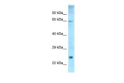 Western Blot: ETFDH Antibody [NBP2-84868]