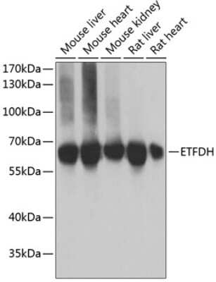 Western Blot: ETFDH AntibodyBSA Free [NBP3-04957]