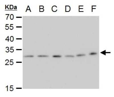 Western Blot: ETHE1 Antibody (1621) [NBP2-43632]