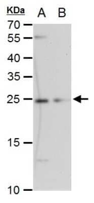 Western Blot: ETHE1 Antibody (1621) [NBP2-43632]