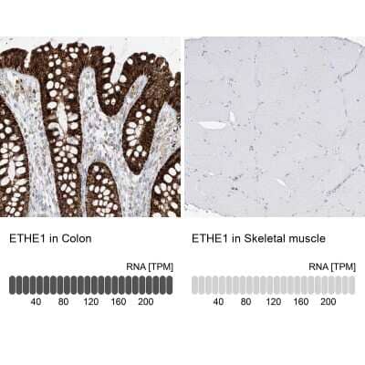 Immunohistochemistry-Paraffin: ETHE1 Antibody [NBP1-81689]