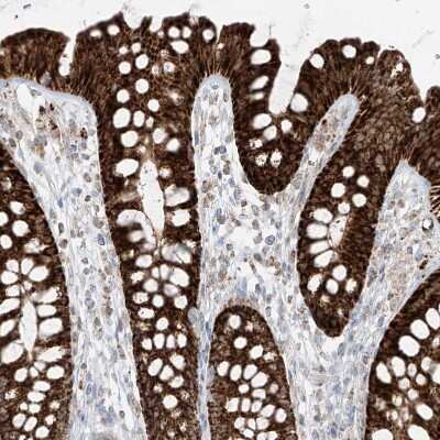 Immunohistochemistry-Paraffin: ETHE1 Antibody [NBP1-81689]