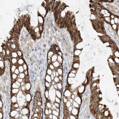 Immunohistochemistry-Paraffin: ETHE1 Antibody [NBP1-81690]