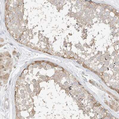 Immunohistochemistry-Paraffin: ETHE1 Antibody [NBP1-81690]