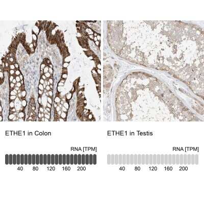 Immunohistochemistry-Paraffin: ETHE1 Antibody [NBP1-81690]