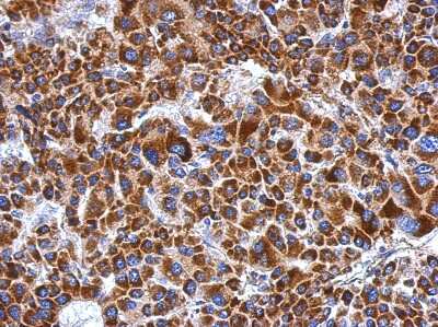 Immunohistochemistry-Paraffin: ETHE1 Antibody [NBP2-16384]