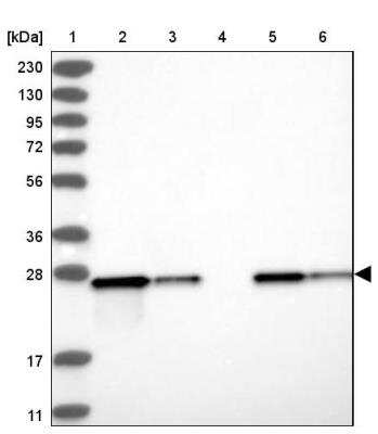 Western Blot: ETHE1 Antibody [NBP1-81689]