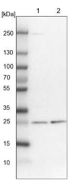 Western Blot: ETHE1 Antibody [NBP1-81689]