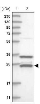 Western Blot: ETHE1 Antibody [NBP1-81690]