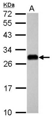 Western Blot: ETHE1 Antibody [NBP2-16384]