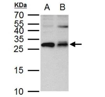 Western Blot: ETHE1 Antibody [NBP2-16384]