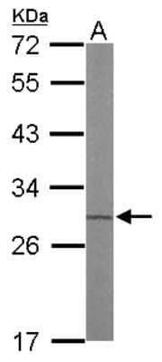 Western Blot: ETHE1 Antibody [NBP2-16385]